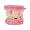 Retraction Pellets: Professional Dental Supplies & Restoratives