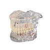 Implants: Industrial & Professional Dental Supplies